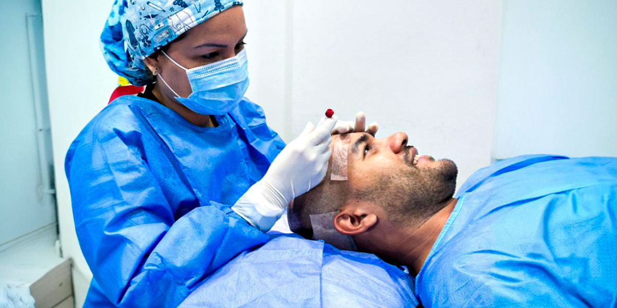 Mitos y verdades sobre el implante capilar