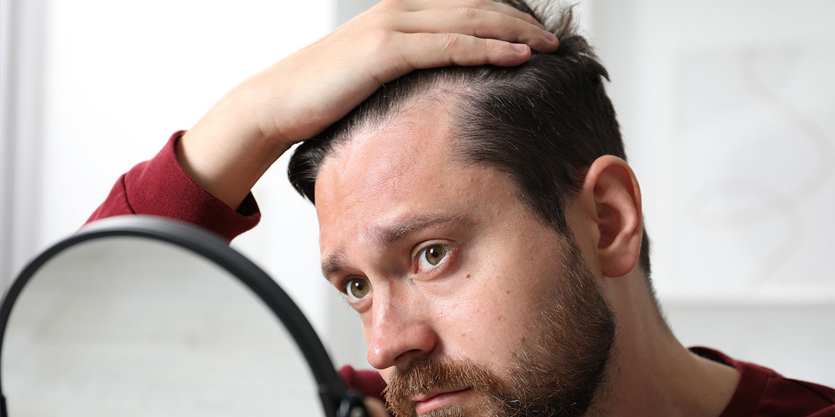 Por qué se me cae el pelo a los 35 años