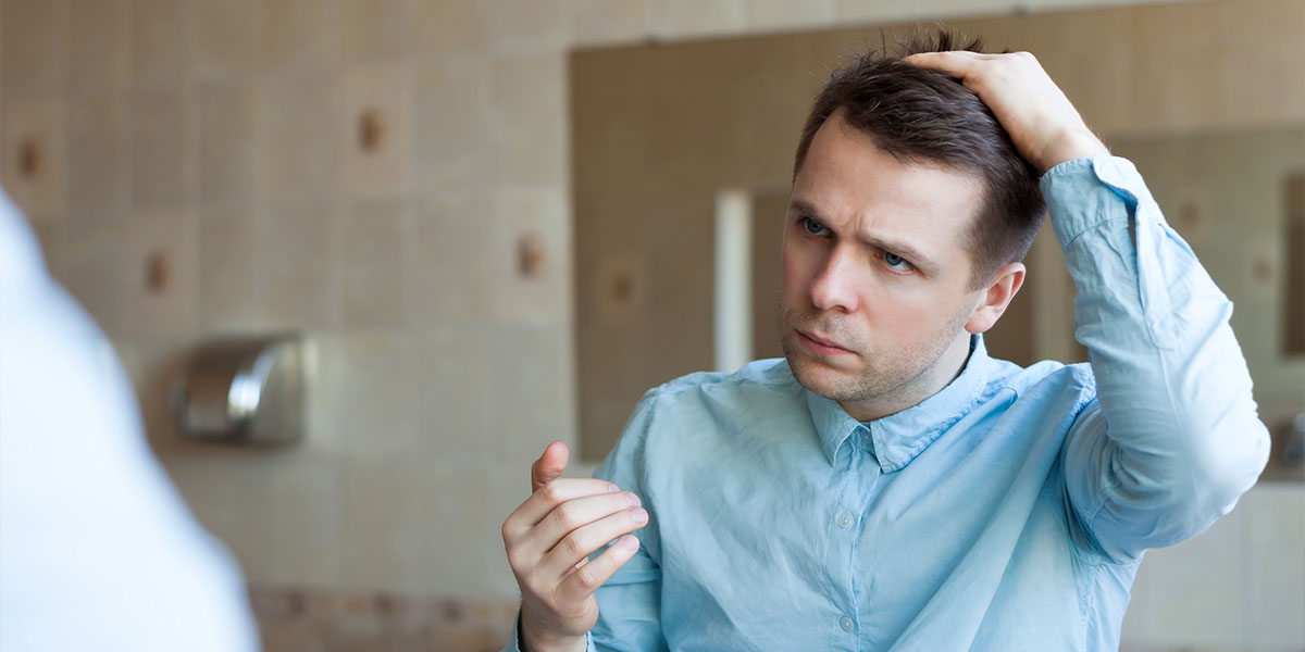 caída de cabello en hombres jóvenes