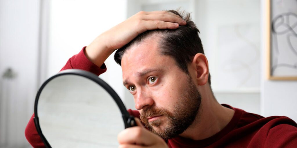 Caída de cabello en hombres jóvenes: La señal silenciosa antes de los 30