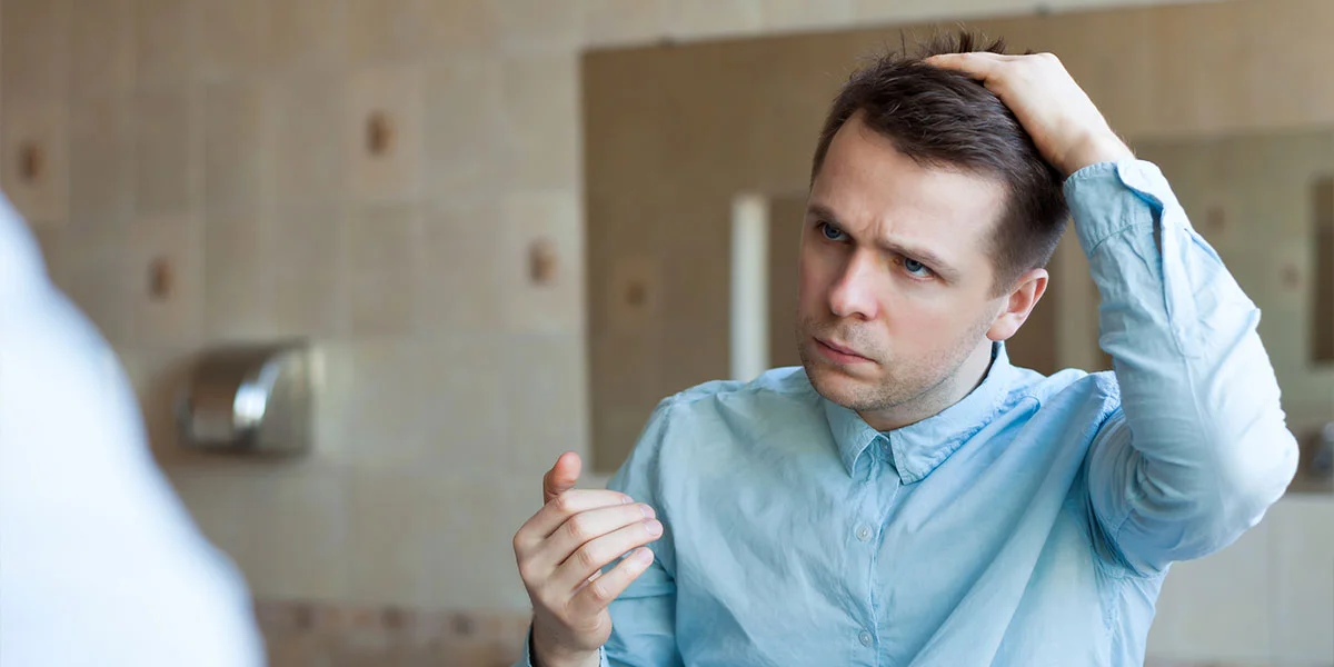 caída de cabello en hombres jóvenes
