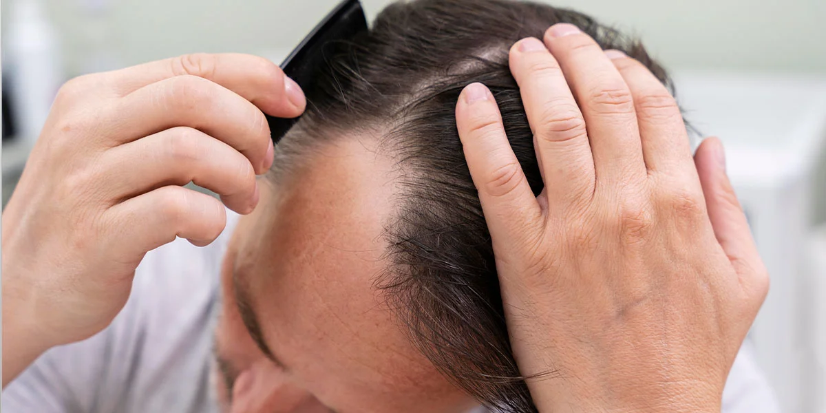 por que se cae tanto el cabello