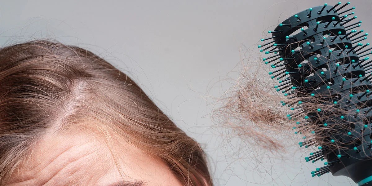 Por Qué se Cae el Cabello